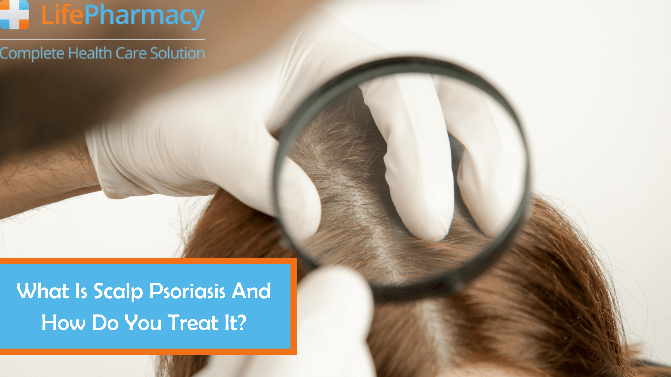 What Is Scalp Psoriasis And How Do You Treat It?