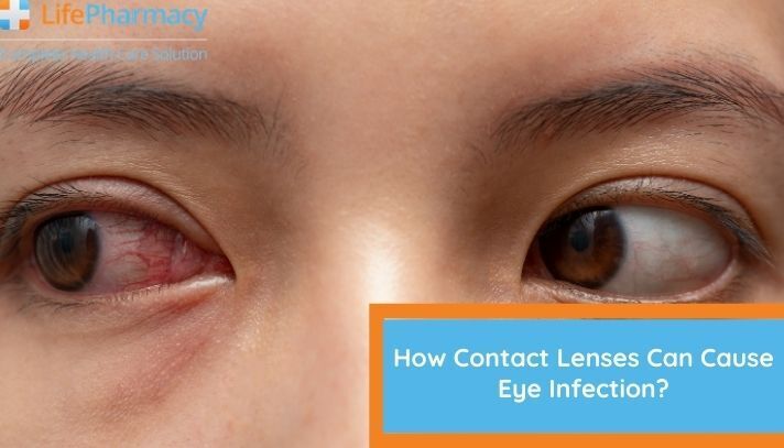 How Contact Lenses Can Cause Eye Infection?