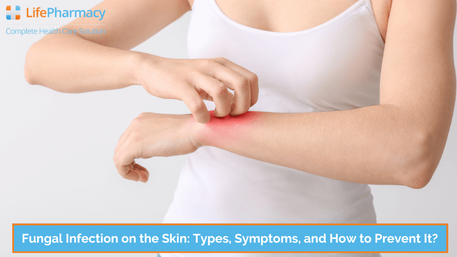 Fungal Infection on the Skin: Types, Symptoms, and How to Prevent It?