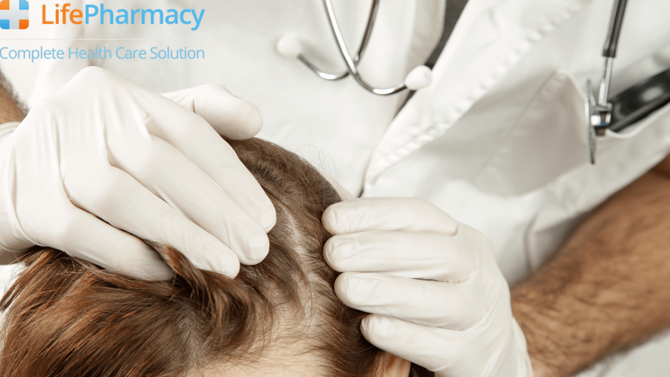 WHAT IS SCALP PSORIASIS AND HOW DO YOU TREAT IT?