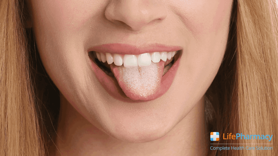 FUNGAL INFECTION ON THE SKIN: TYPES, SYMPTOMS, AND HOW TO PREVENT IT?